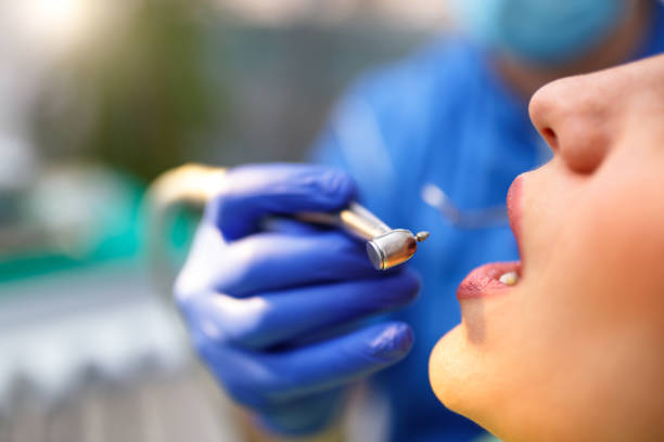 Dental Inlays and Onlays in Hebron, OH